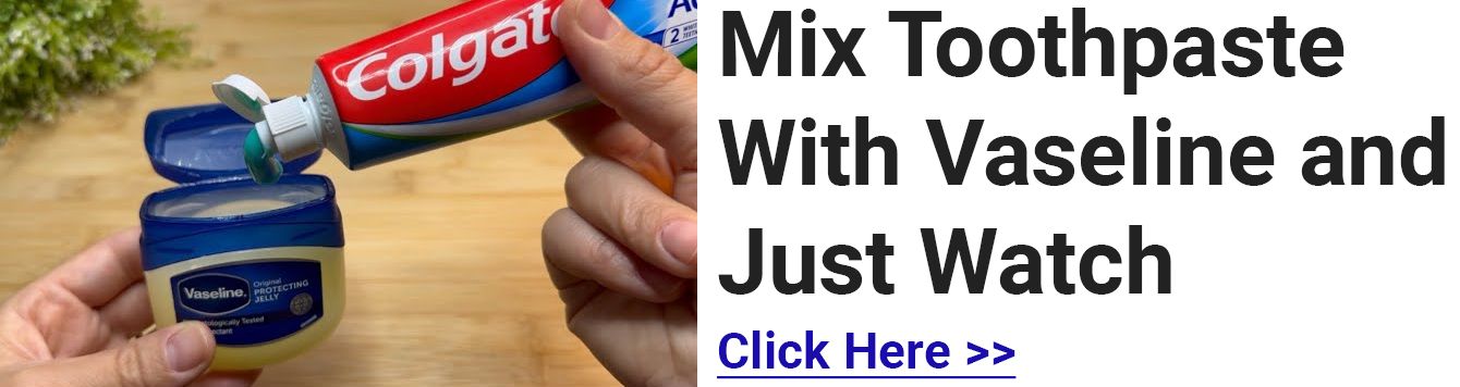 181 Coolest Creative iPhone Cases Make Your Phone Unforgettable Forever 14 image 100